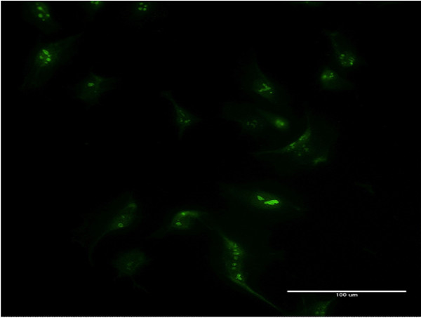 MSX1 Antibody in Immunocytochemistry (ICC/IF)