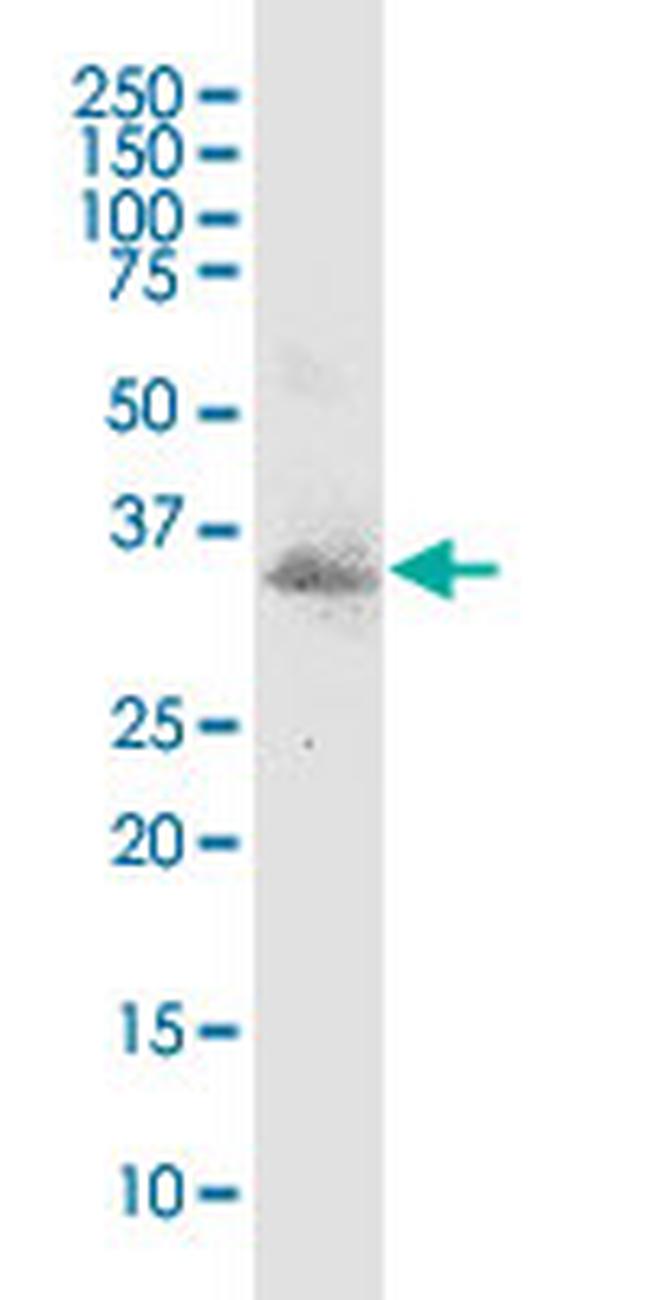 MSX1 Antibody in Western Blot (WB)