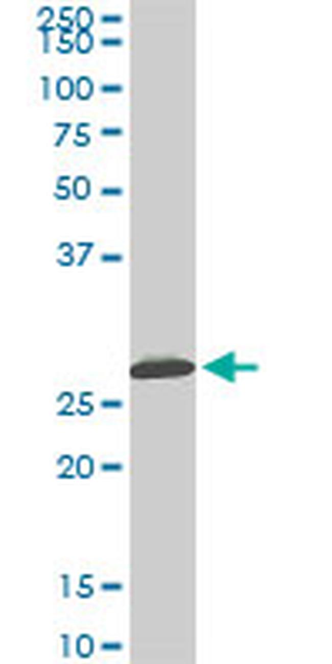 MTAP Antibody in Western Blot (WB)