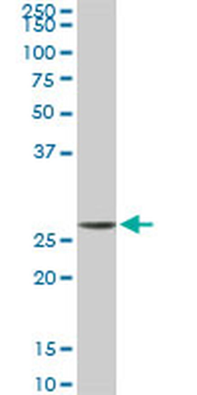 MTAP Antibody in Western Blot (WB)