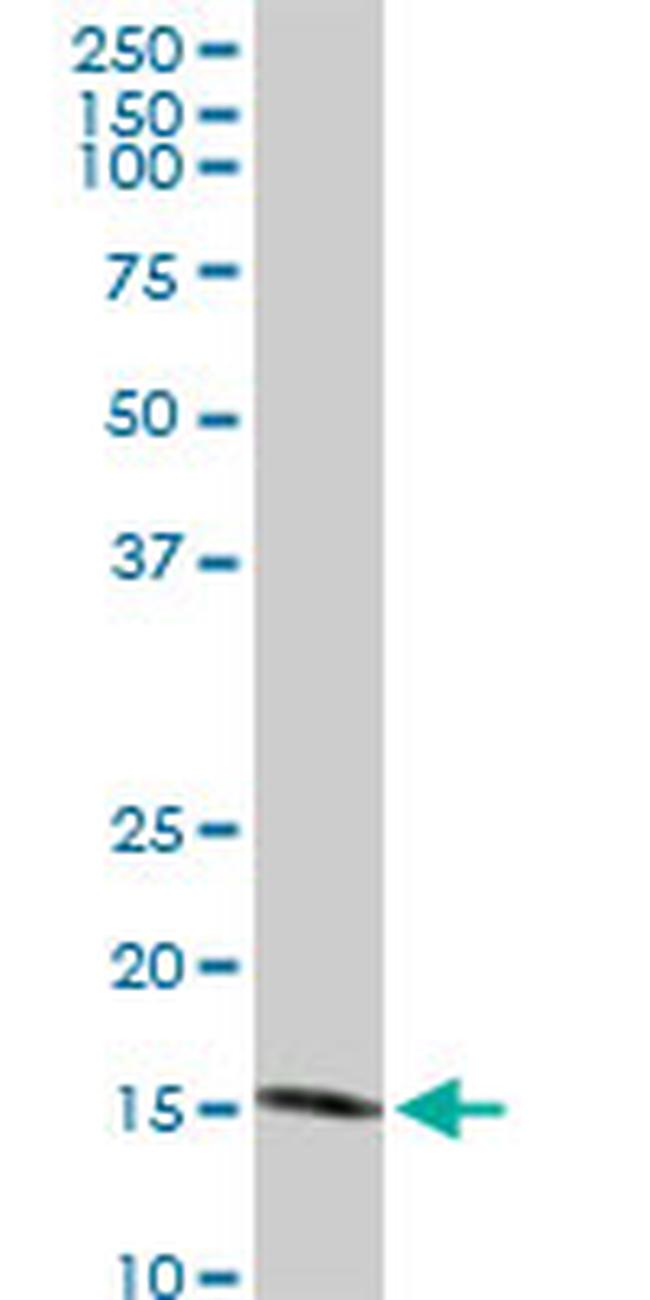 NUDT1 Antibody in Western Blot (WB)