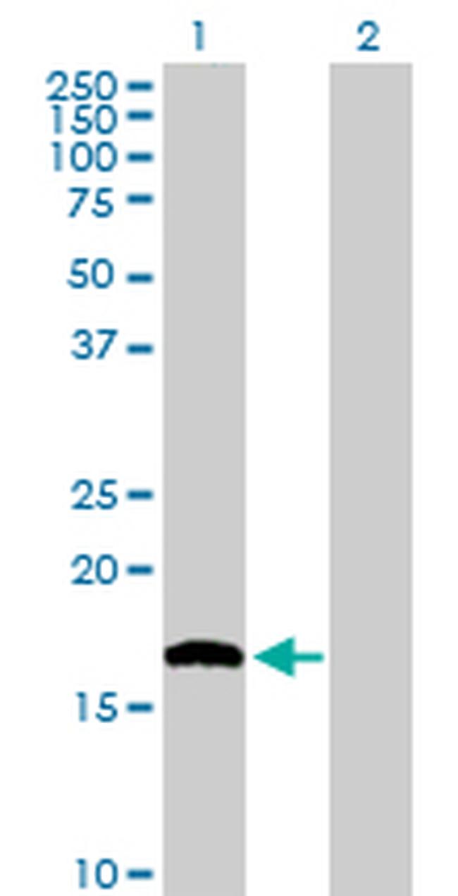 NUDT1 Antibody in Western Blot (WB)