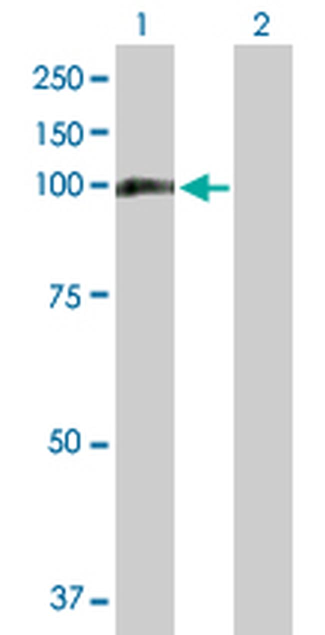 MTHFD1 Antibody in Western Blot (WB)