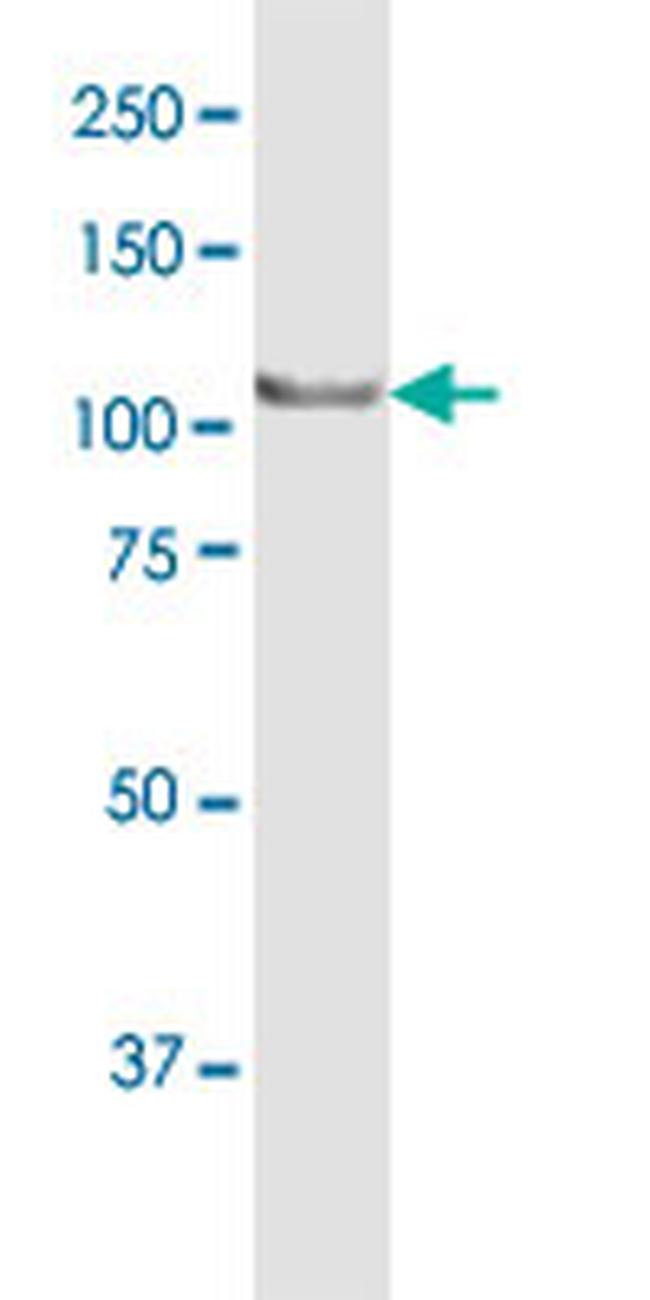 MTHFD1 Antibody in Western Blot (WB)