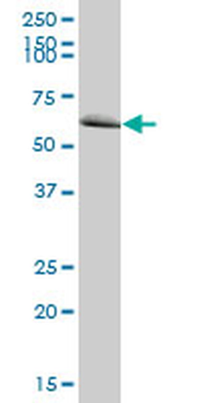 MTM1 Antibody in Western Blot (WB)