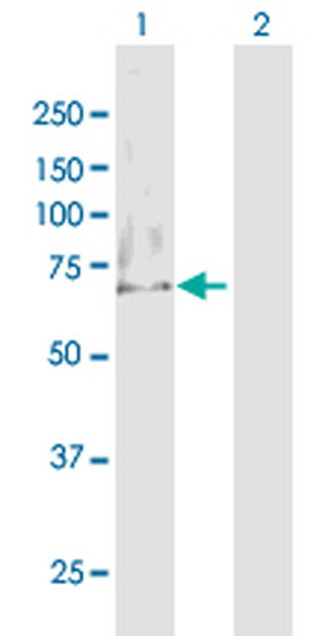 MTM1 Antibody in Western Blot (WB)