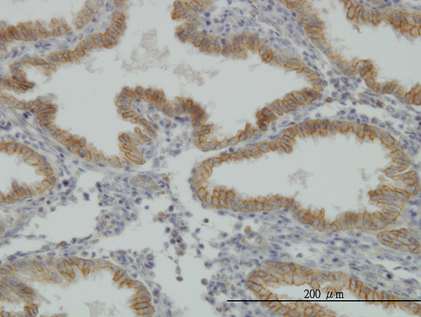 MUSK Antibody in Immunohistochemistry (Paraffin) (IHC (P))