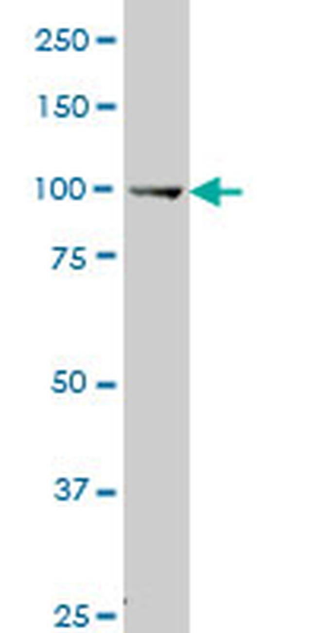 MUSK Antibody in Western Blot (WB)