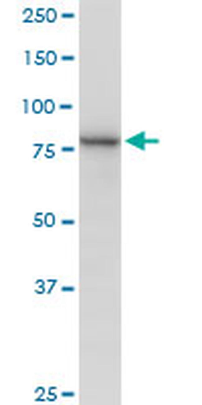 MUT Antibody in Western Blot (WB)