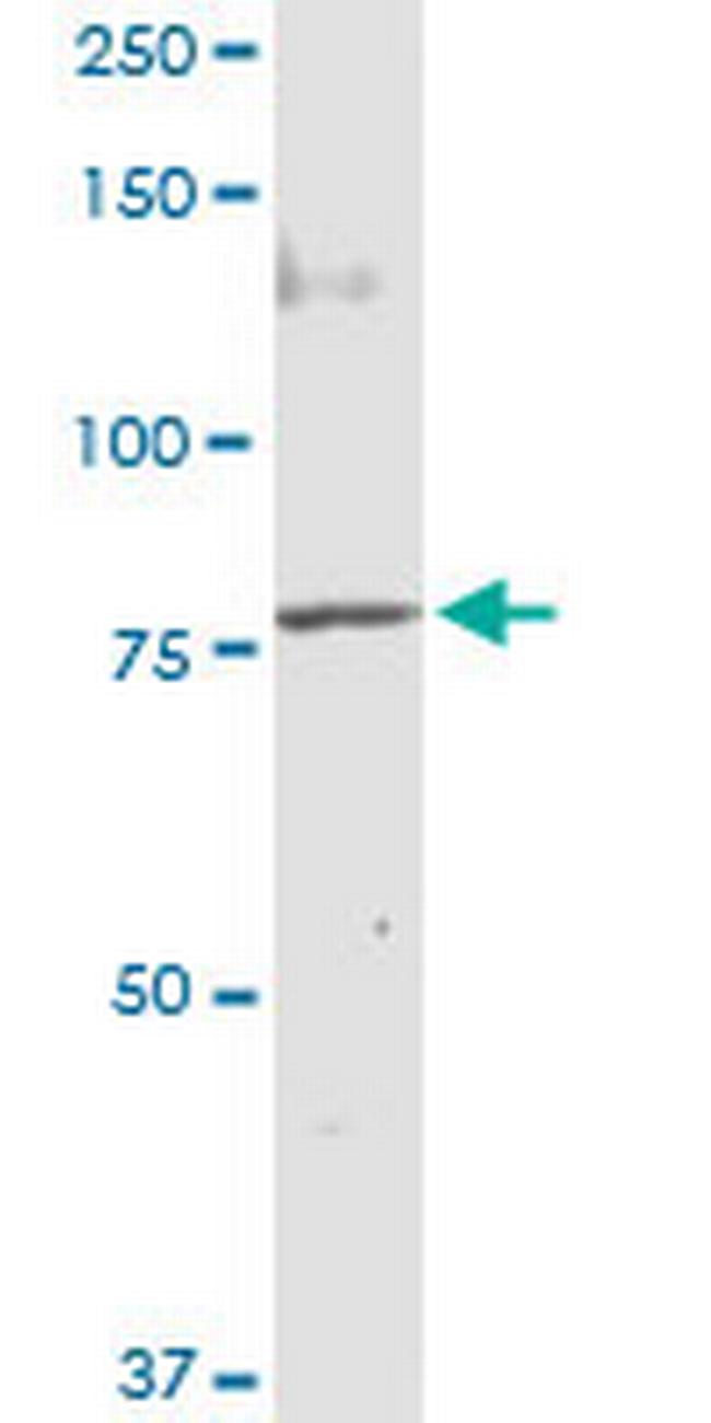 MUT Antibody in Western Blot (WB)