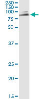 MUTYH Antibody in Immunoprecipitation (IP)