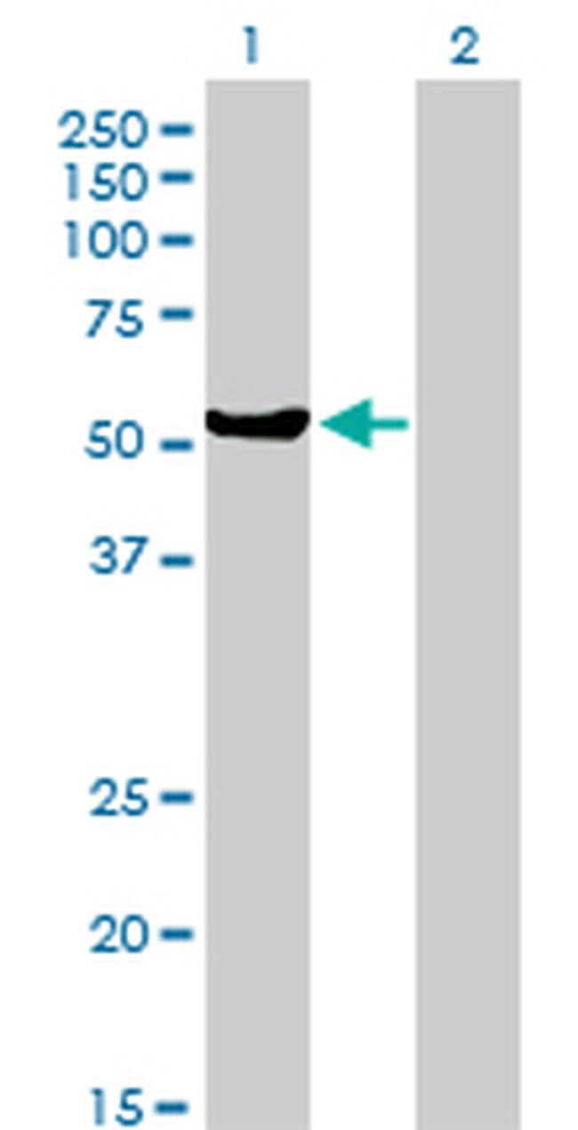 MUTYH Antibody in Western Blot (WB)