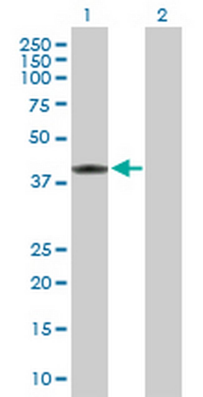 MVK Antibody in Western Blot (WB)