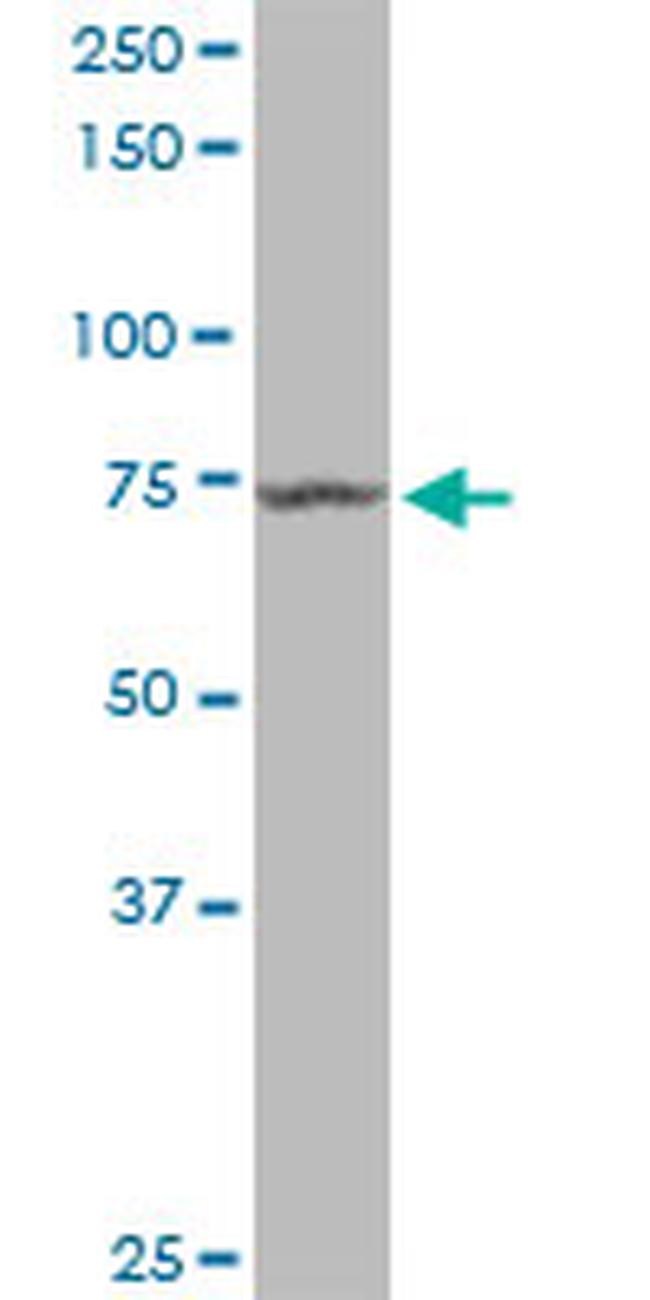 MX1 Antibody in Western Blot (WB)