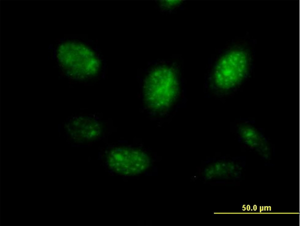 MYB Antibody in Immunocytochemistry (ICC/IF)