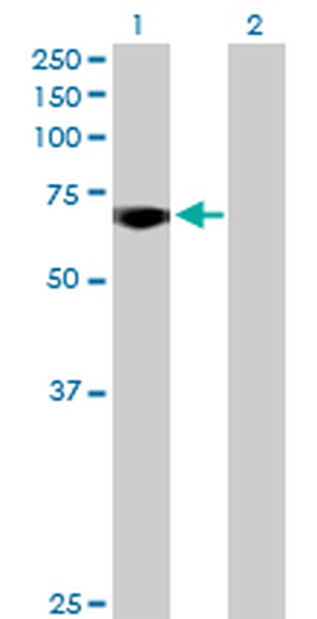 MYBL2 Antibody in Western Blot (WB)