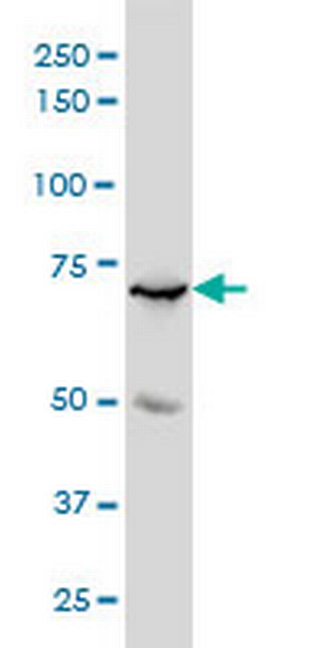 MYBL2 Antibody in Western Blot (WB)