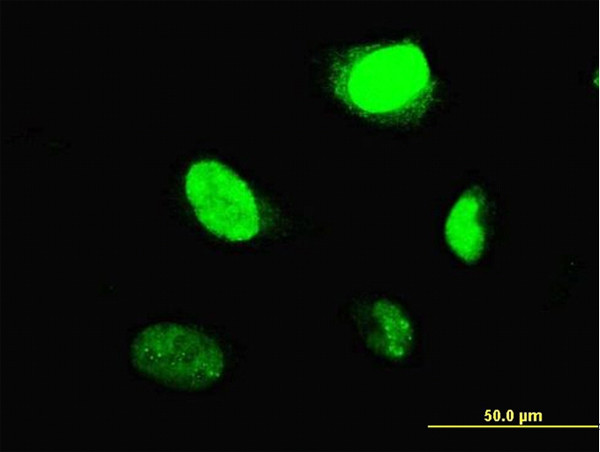 MYBL2 Antibody in Immunocytochemistry (ICC/IF)