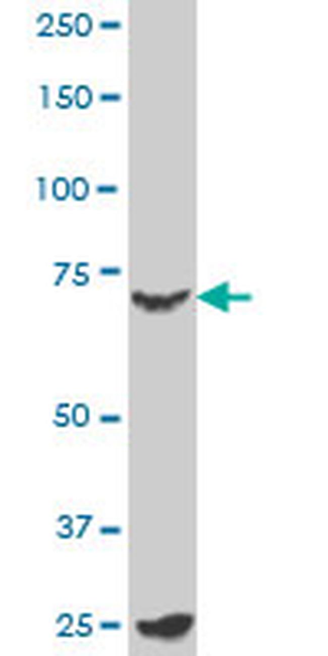 MYBL2 Antibody in Western Blot (WB)