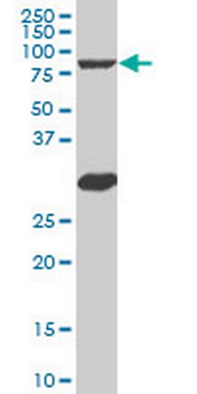 MYBL2 Antibody in Western Blot (WB)