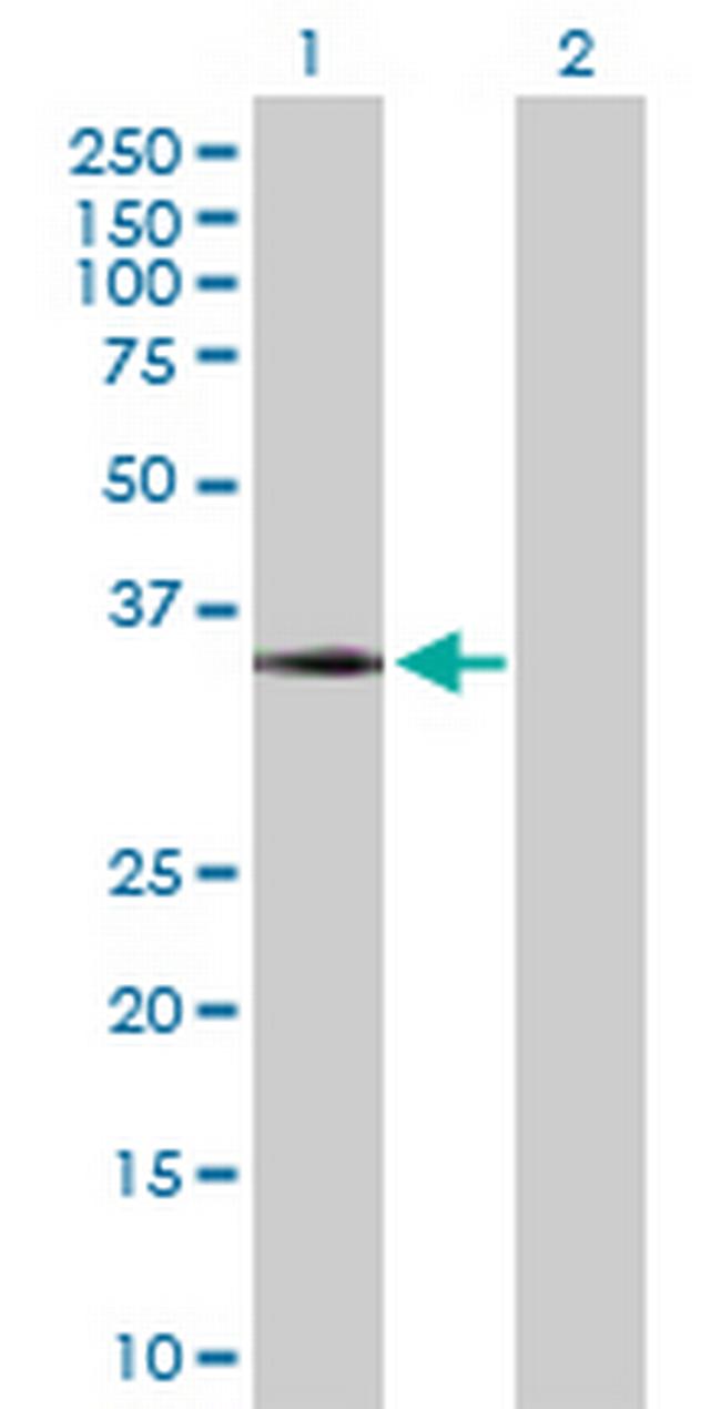 MYD88 Antibody in Western Blot (WB)