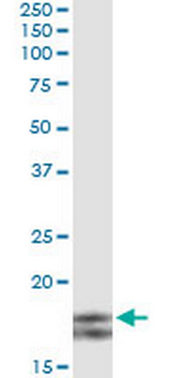 MYL2 Antibody in Immunoprecipitation (IP)