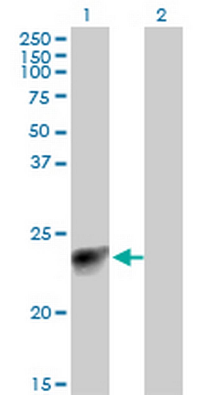 MYL3 Antibody in Western Blot (WB)