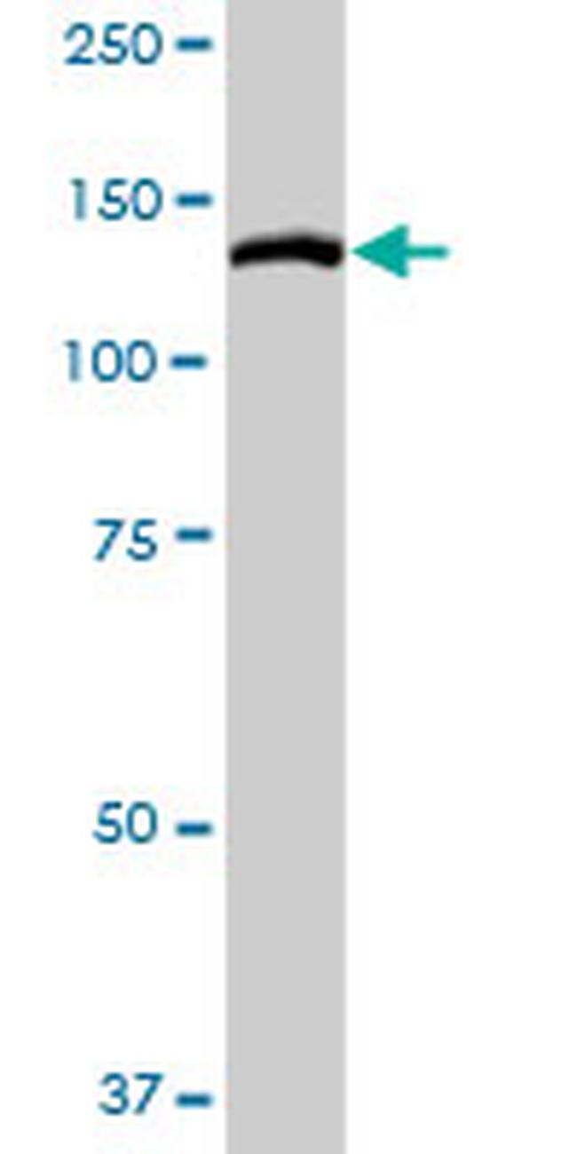 MYLK Antibody in Western Blot (WB)