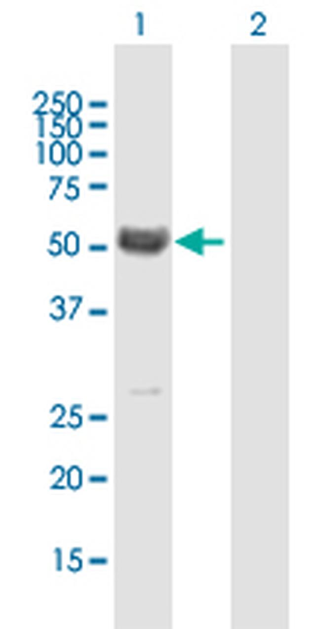 MYOC Antibody in Western Blot (WB)