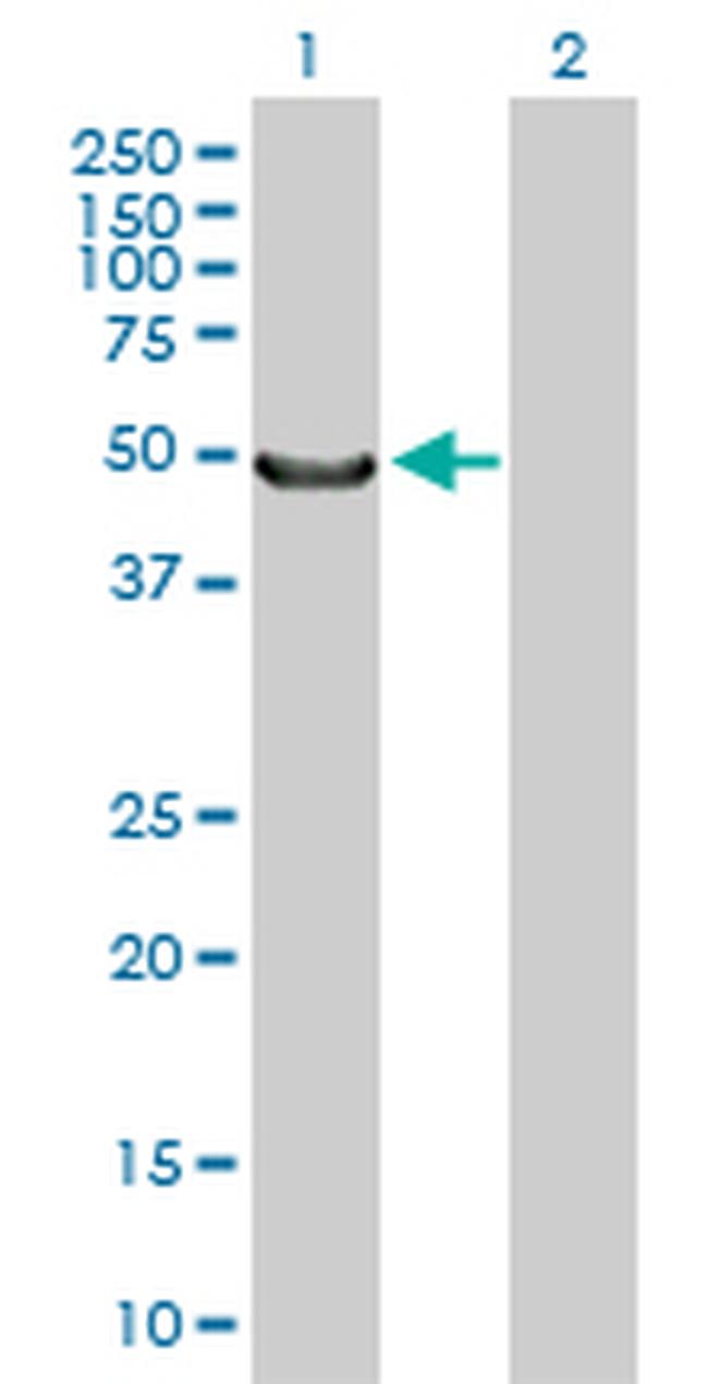 MYOC Antibody in Western Blot (WB)