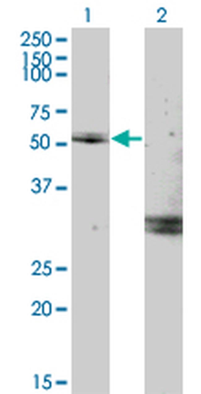 MYOC Antibody in Western Blot (WB)