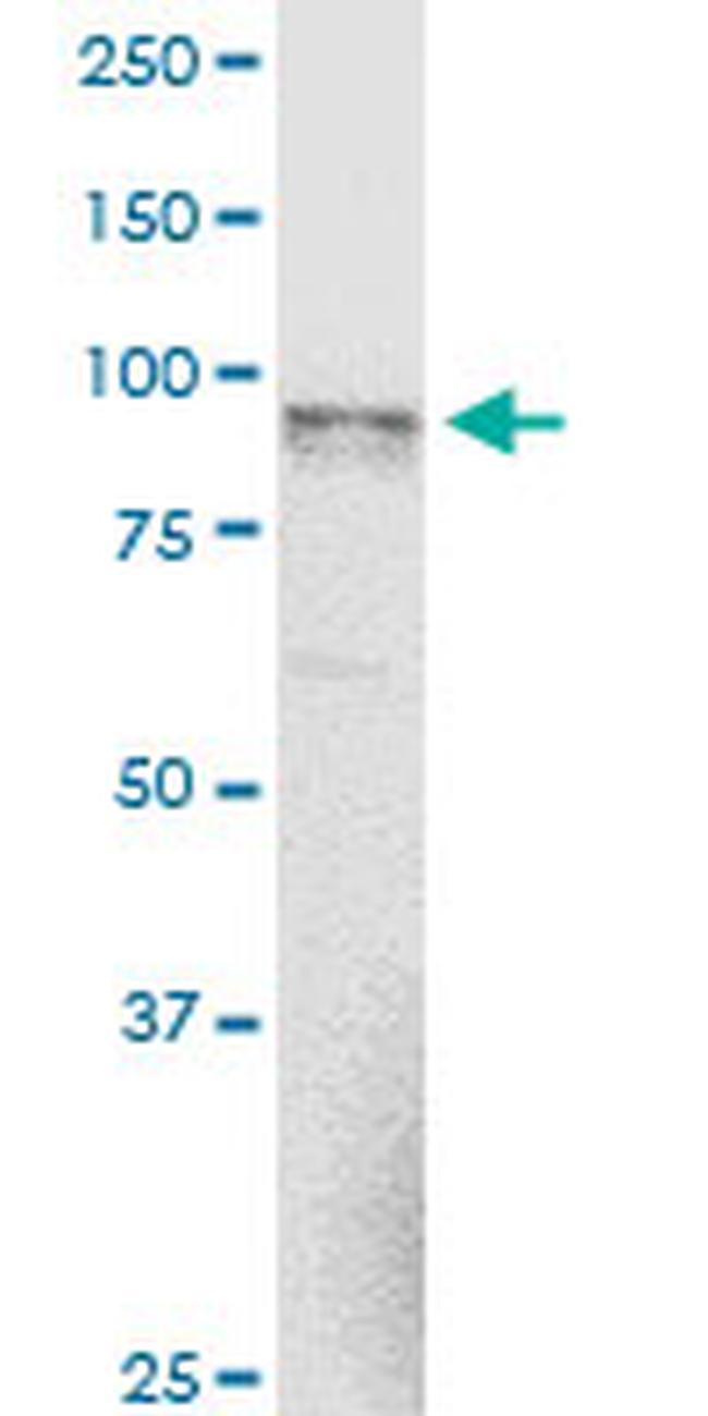 NAGLU Antibody in Western Blot (WB)