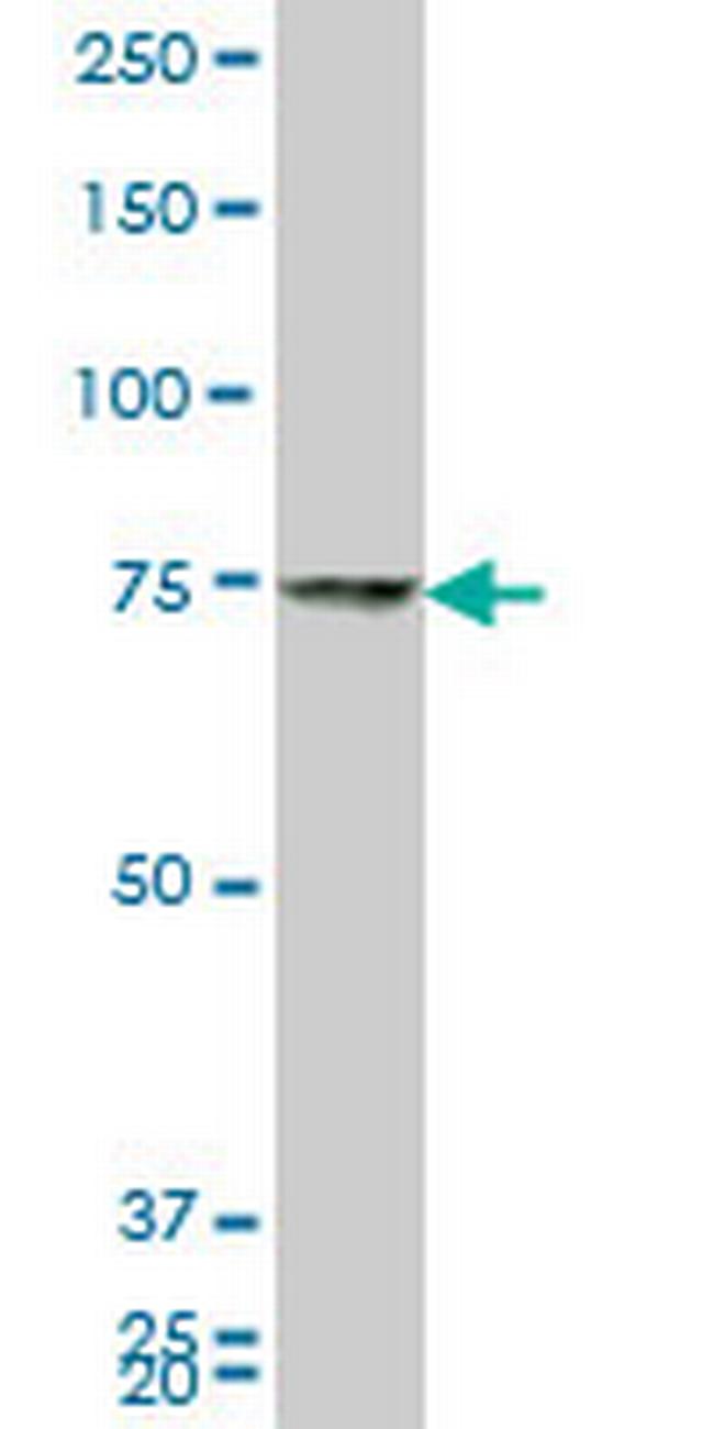 HNRPM Antibody in Western Blot (WB)