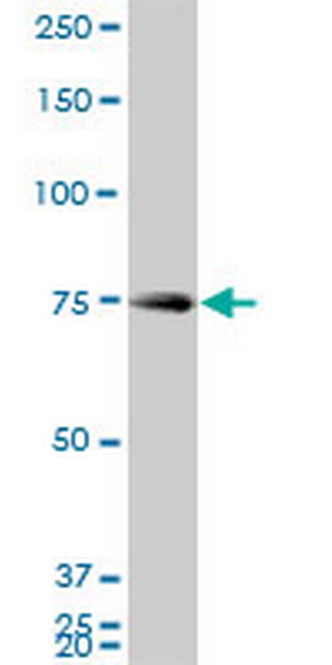 HNRPM Antibody in Western Blot (WB)