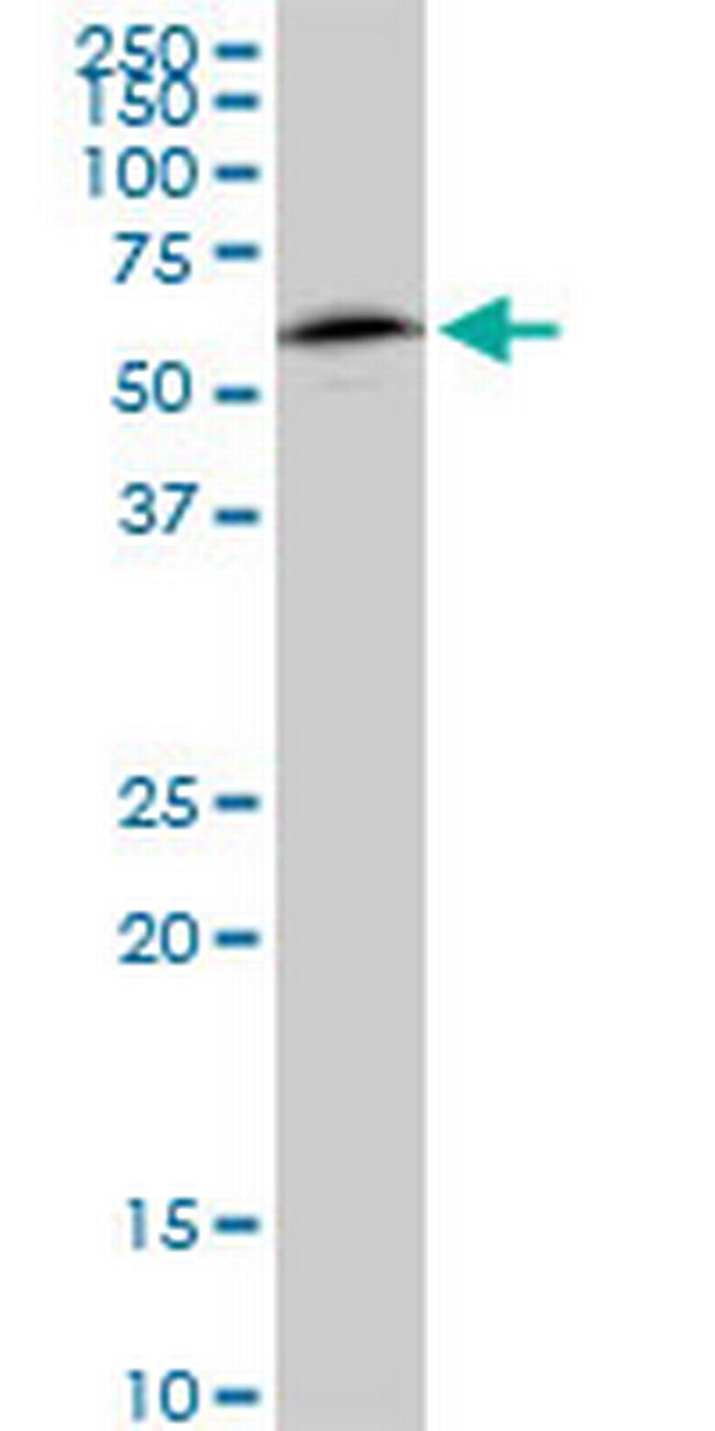 NAP1L1 Antibody in Western Blot (WB)