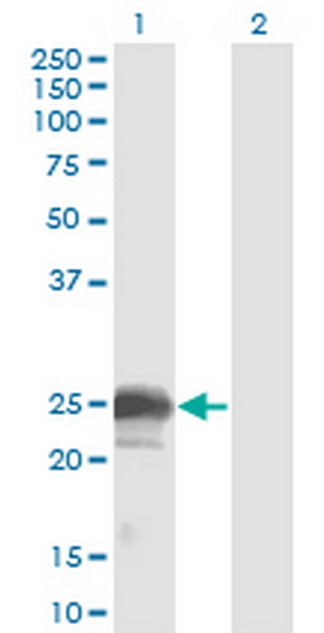 NBL1 Antibody in Western Blot (WB)