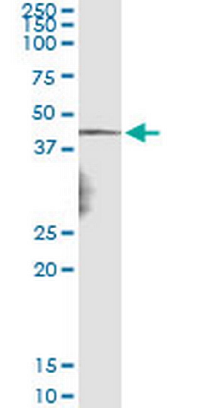 NDN Antibody in Immunoprecipitation (IP)