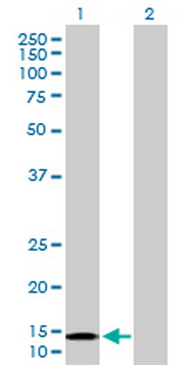 NDUFB6 Antibody in Western Blot (WB)