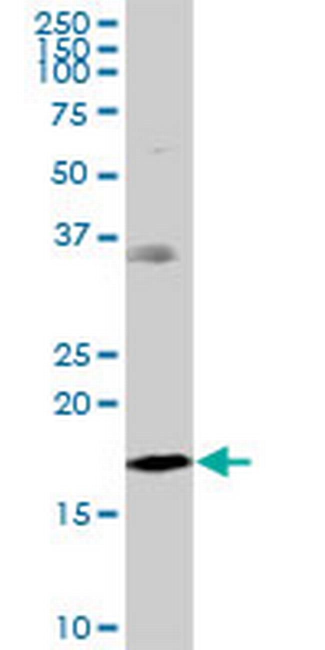 NDUFB7 Antibody in Western Blot (WB)