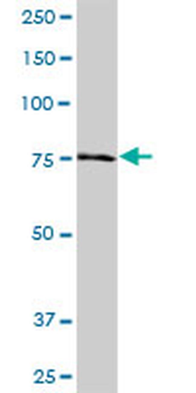 NDUFS1 Antibody in Western Blot (WB)