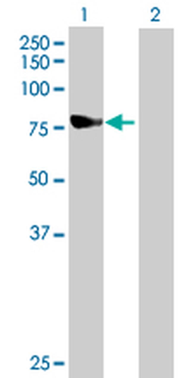 NDUFS1 Antibody in Western Blot (WB)