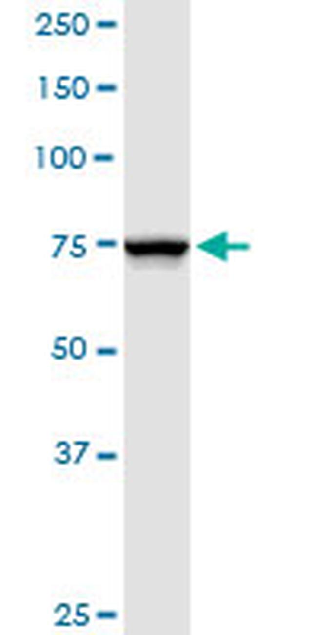 NDUFS1 Antibody in Western Blot (WB)