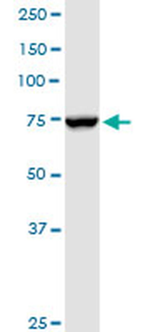 NDUFS1 Antibody in Western Blot (WB)