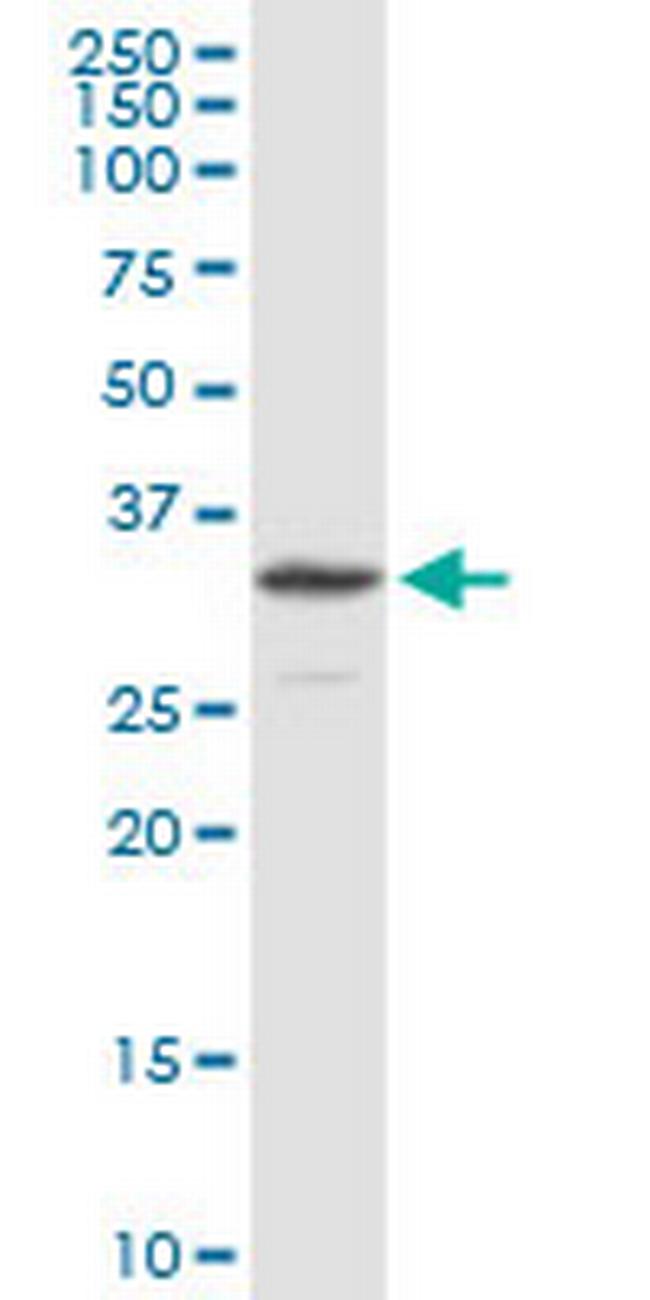 NDUFS3 Antibody in Western Blot (WB)