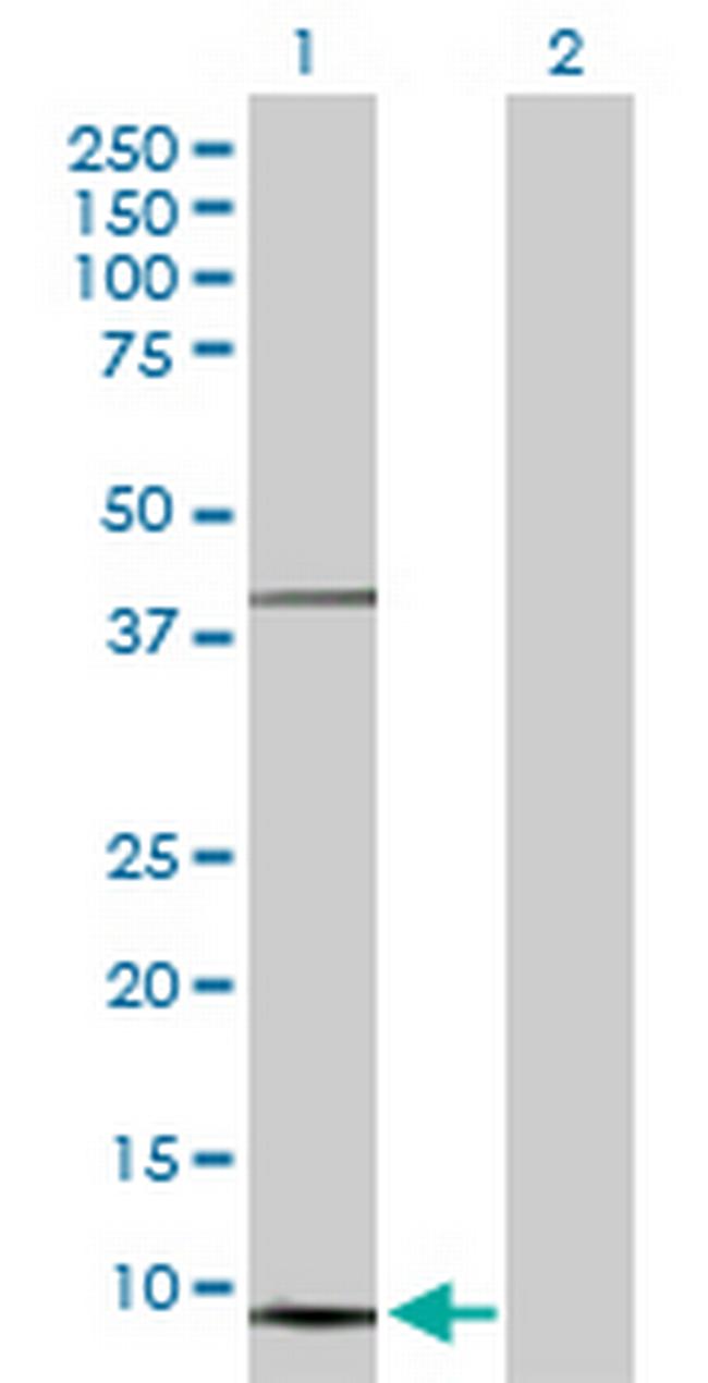 NDUFS5 Antibody in Western Blot (WB)