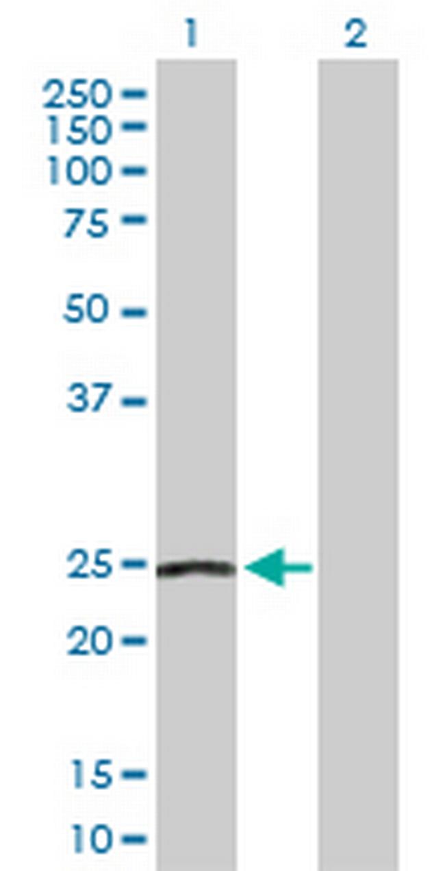 NDUFS8 Antibody in Western Blot (WB)