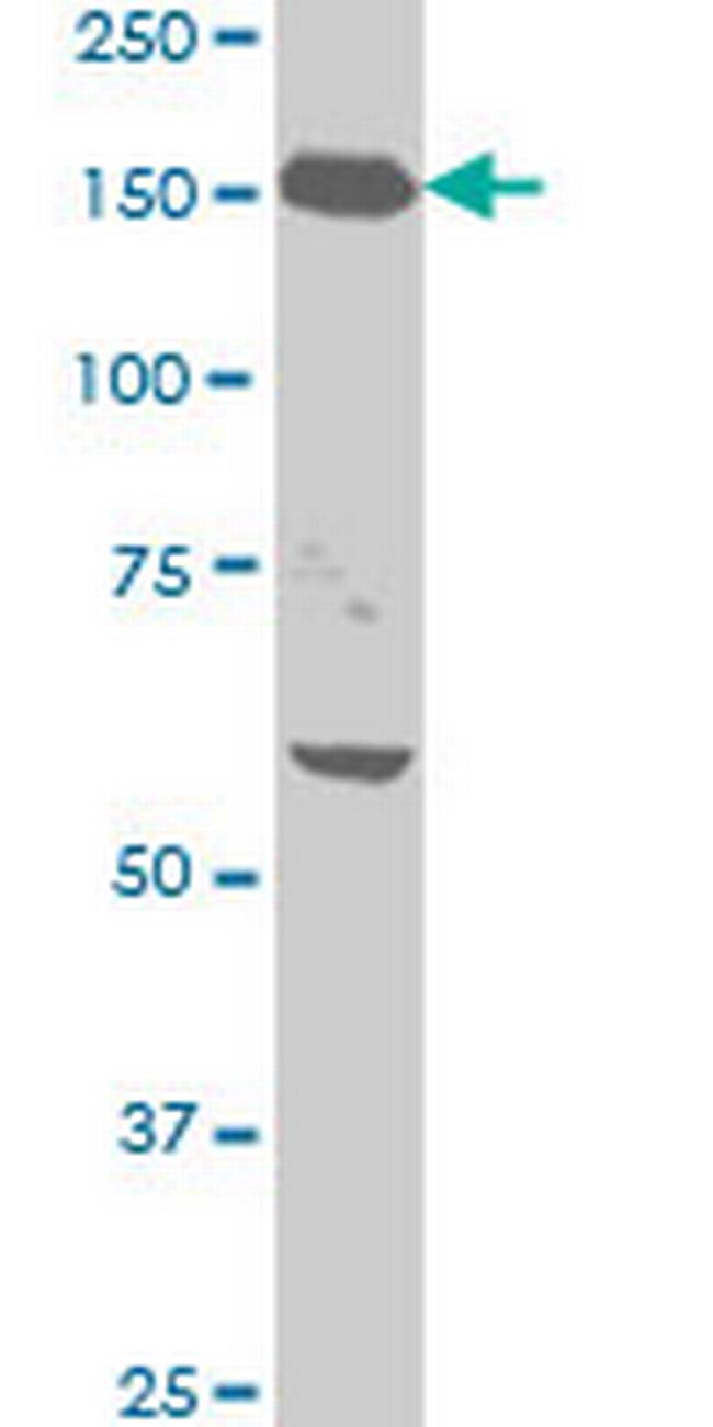 NEFH Antibody in Western Blot (WB)