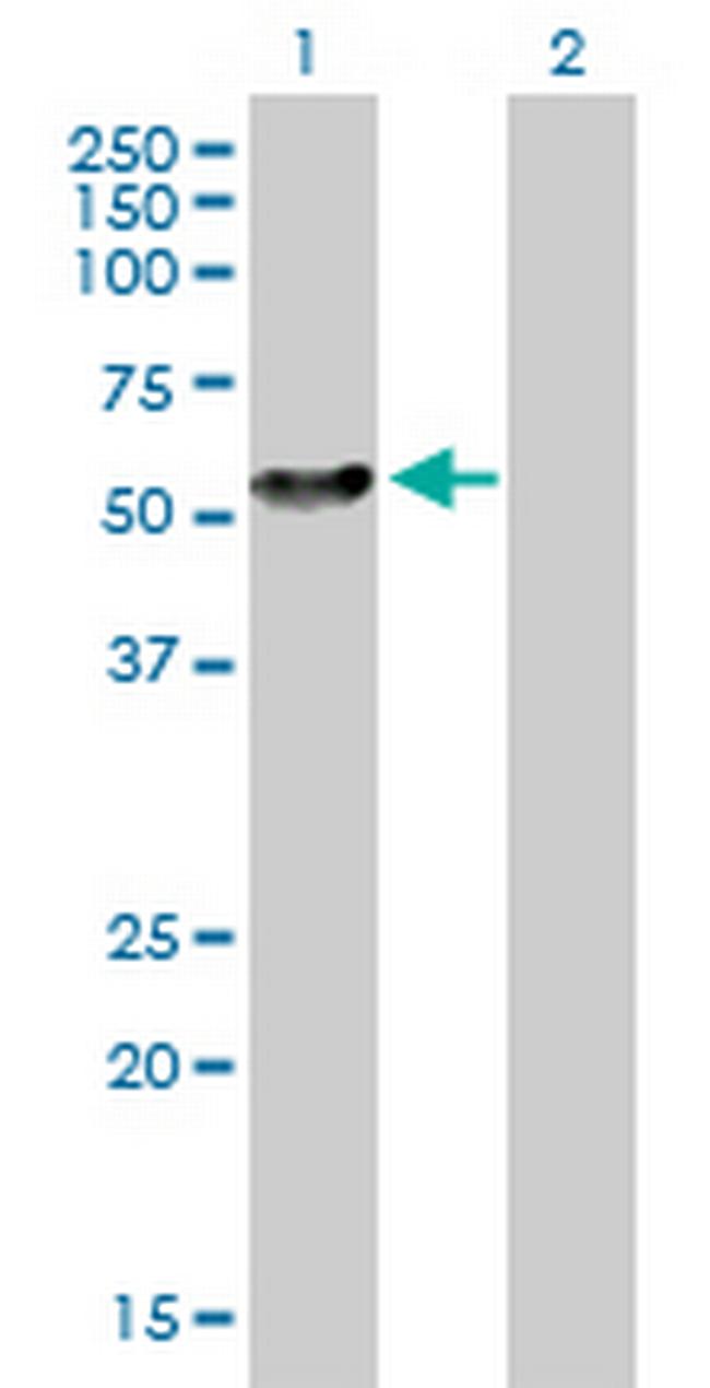 NEK2 Antibody in Western Blot (WB)