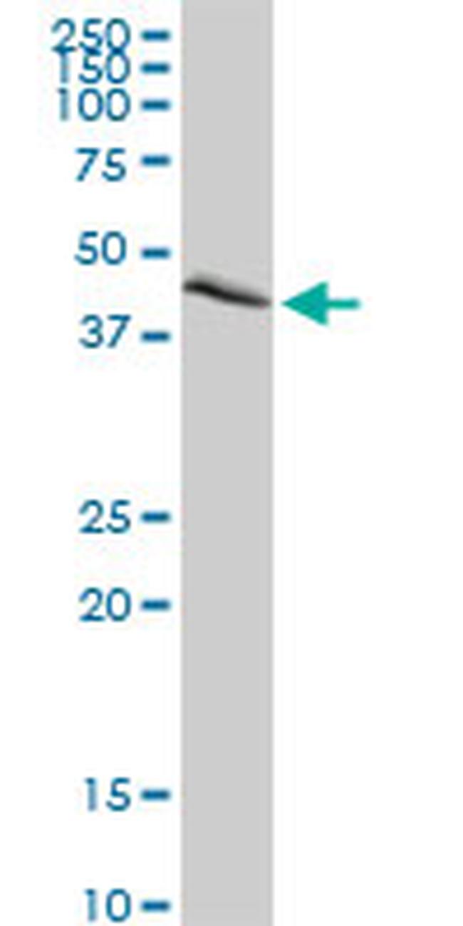 NEK2 Antibody in Western Blot (WB)