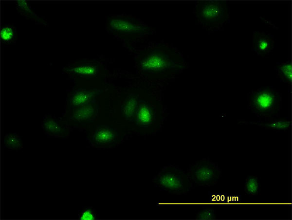 NEK2 Antibody in Immunocytochemistry (ICC/IF)